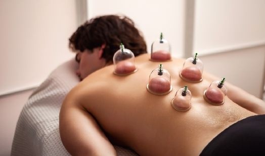 Cupping Full body