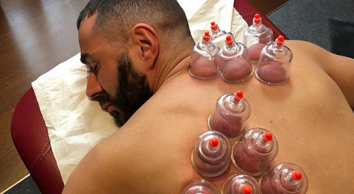 Cupping dos